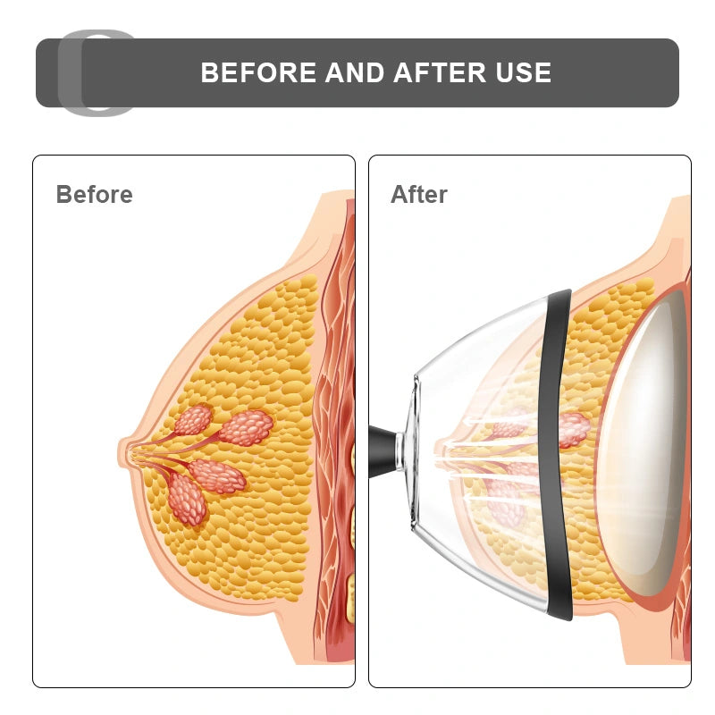 Female Pussy Sucker Automatic Vacuum Vagina Pump