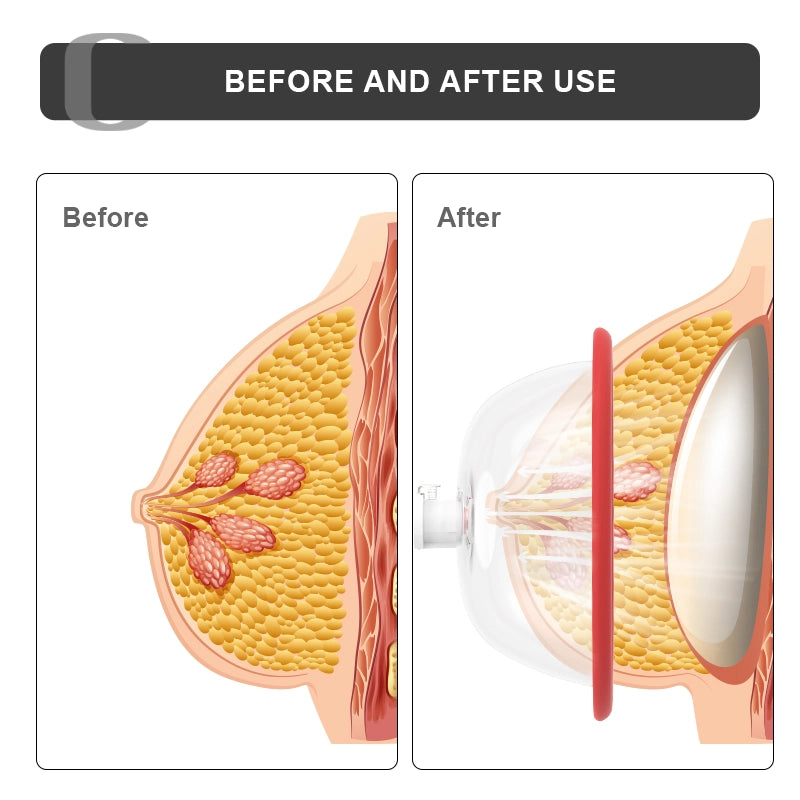 Portable Electric Vacuum Vagina Pump